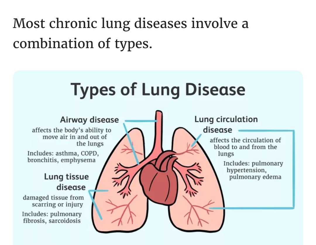 Respiratory Infections